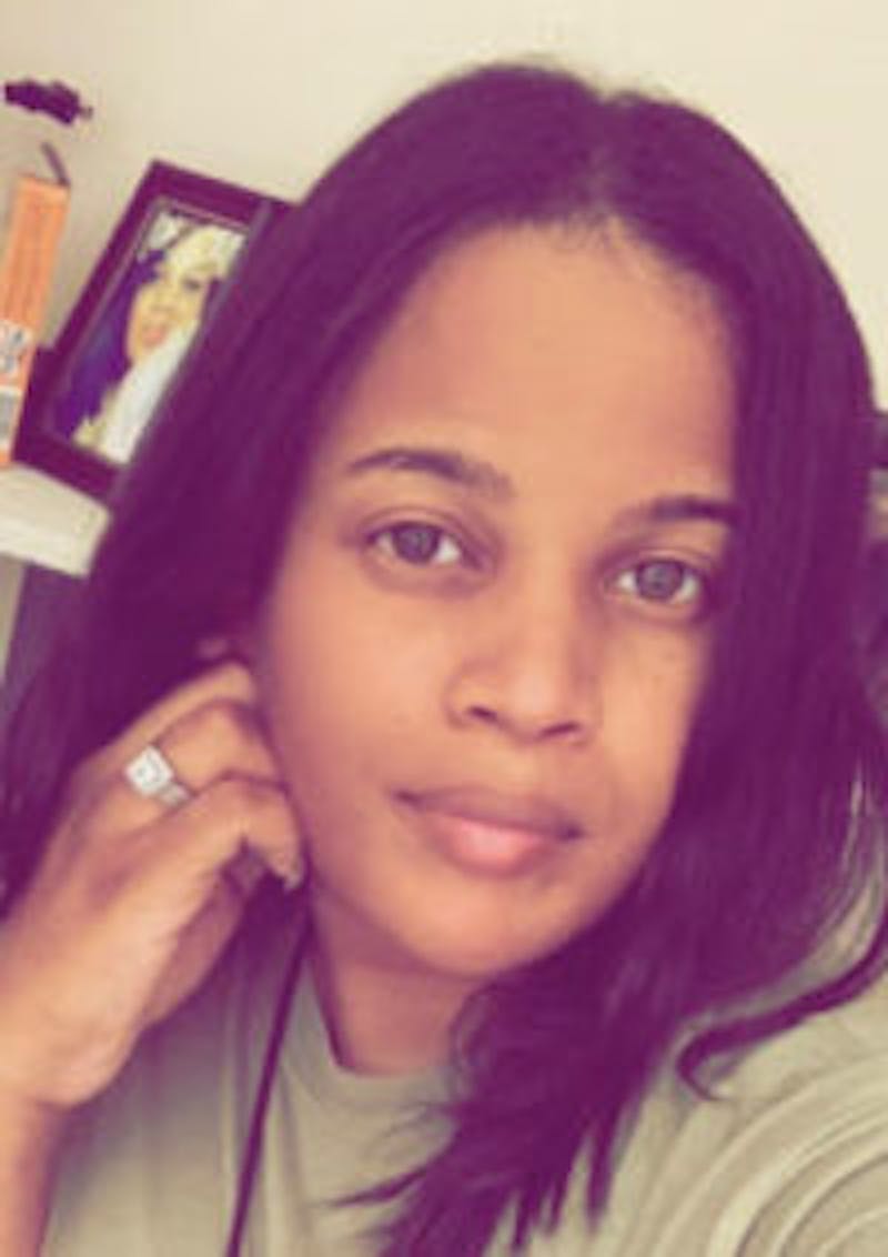 FFS Before & After Gallery - Patient 328442 - Image 2