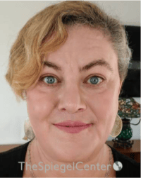 FFS Before & After Gallery - Patient 115914 - Image 2