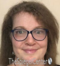 FFS Before & After Gallery - Patient 615340 - Image 2