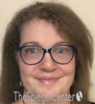 FFS Before & After Gallery - Patient 615340 - Image 2
