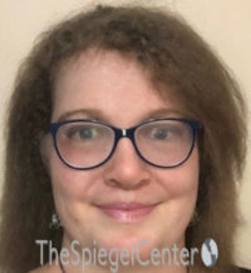 FFS Before & After Gallery - Patient 615340 - Image 2