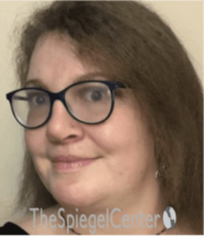 FFS Before & After Gallery - Patient 615340 - Image 4