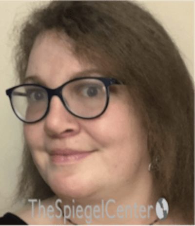 FFS Before & After Gallery - Patient 615340 - Image 4