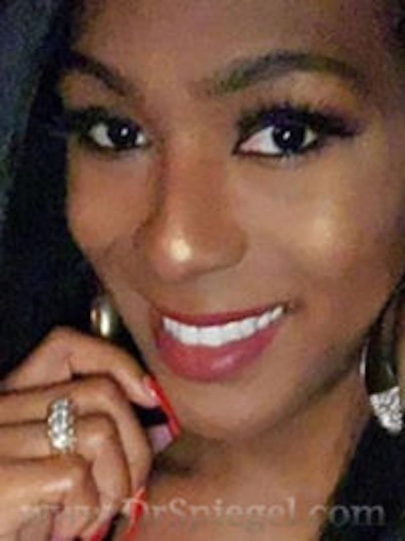 FFS Before & After Gallery - Patient 657852 - Image 2