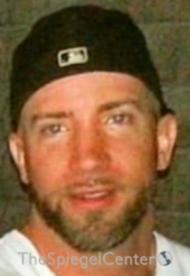 FFS Before & After Gallery - Patient 163336 - Image 1