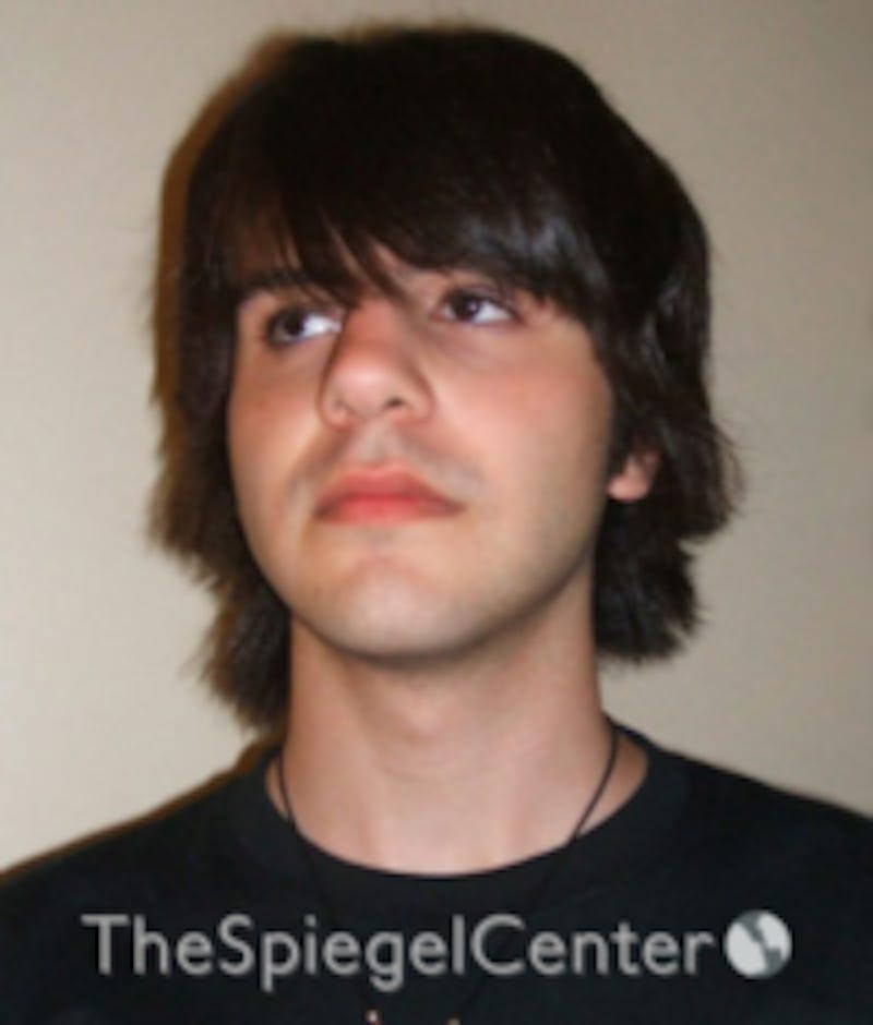 FFS Before & After Gallery - Patient 280955 - Image 1