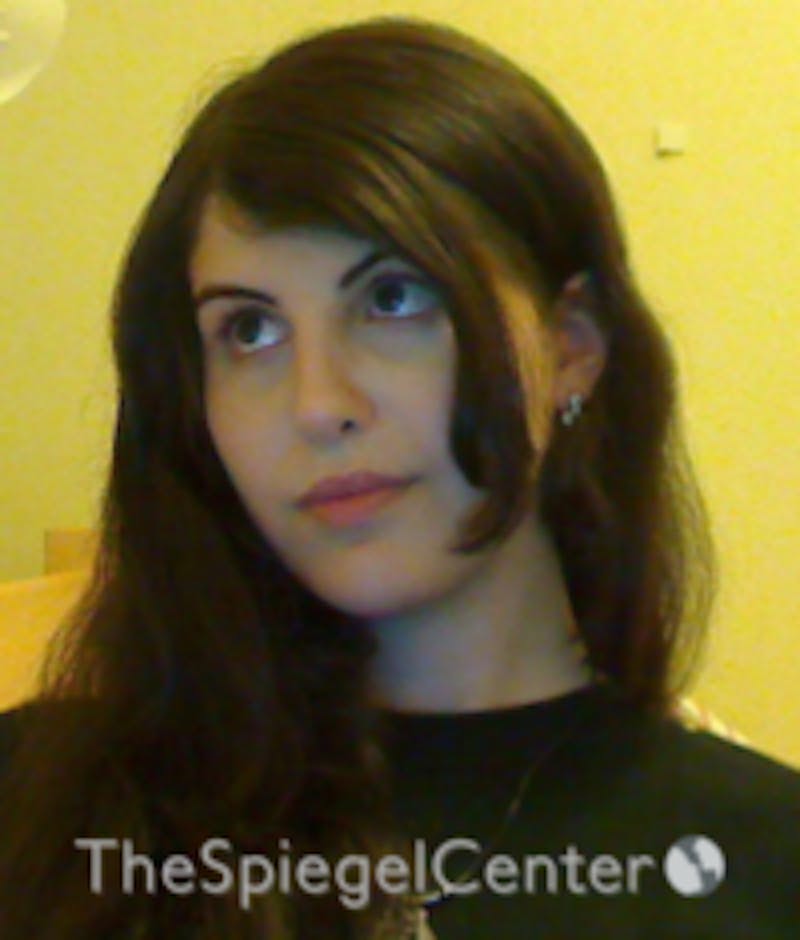 FFS Before & After Gallery - Patient 280955 - Image 2