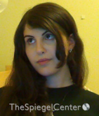 FFS Before & After Gallery - Patient 280955 - Image 2