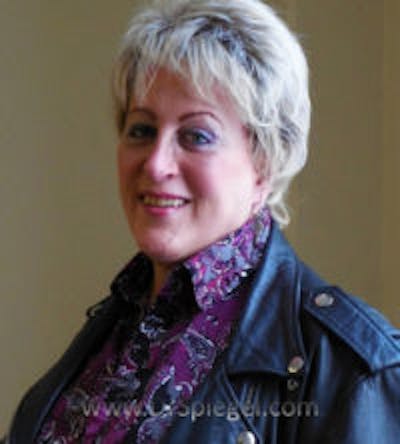 FFS Before & After Gallery - Patient 331630 - Image 2