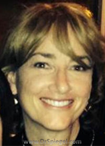 FFS Before & After Gallery - Patient 198840 - Image 2