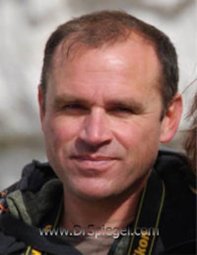 FFS Before & After Gallery - Patient 269678 - Image 1