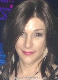 FFS Before & After Gallery - Patient 518246 - Image 2