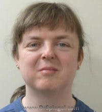 FFS Before & After Gallery - Patient 280454 - Image 1