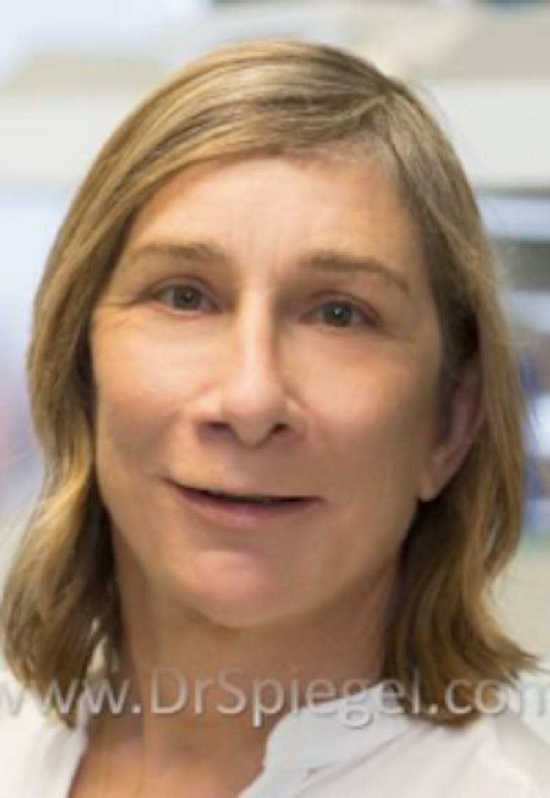 FFS Before & After Gallery - Patient 191196 - Image 2