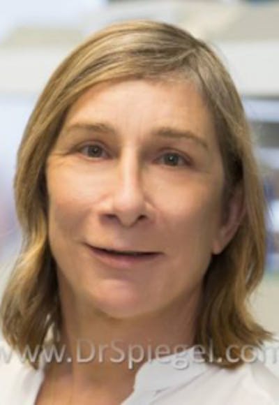 FFS Before & After Gallery - Patient 191196 - Image 2