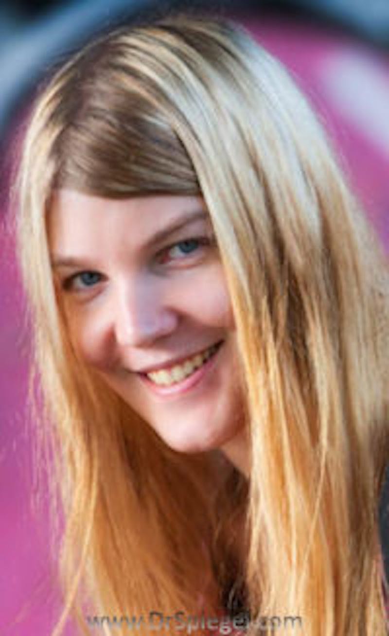 FFS Before & After Gallery - Patient 225140 - Image 2