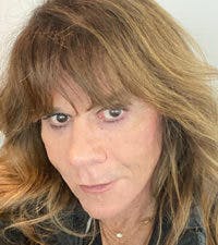 FFS Non-Surgical Feminization Before & After Gallery - Patient 122536 - Image 2