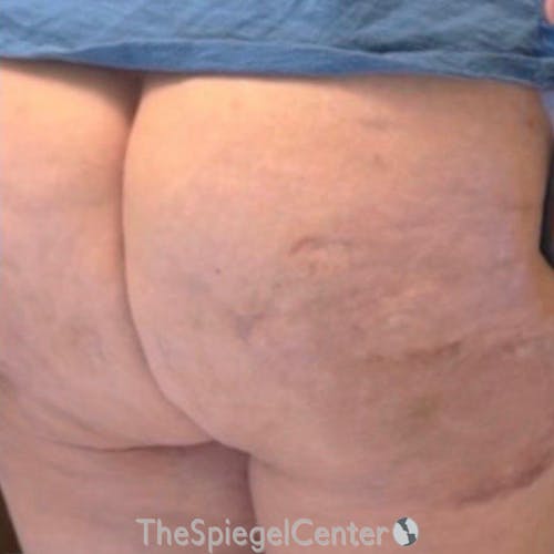 Junera Before & After Gallery - Patient 253095 - Image 2