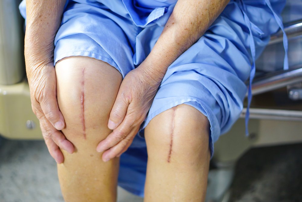 Laborde Earles Injury Lawyers FAQ | 