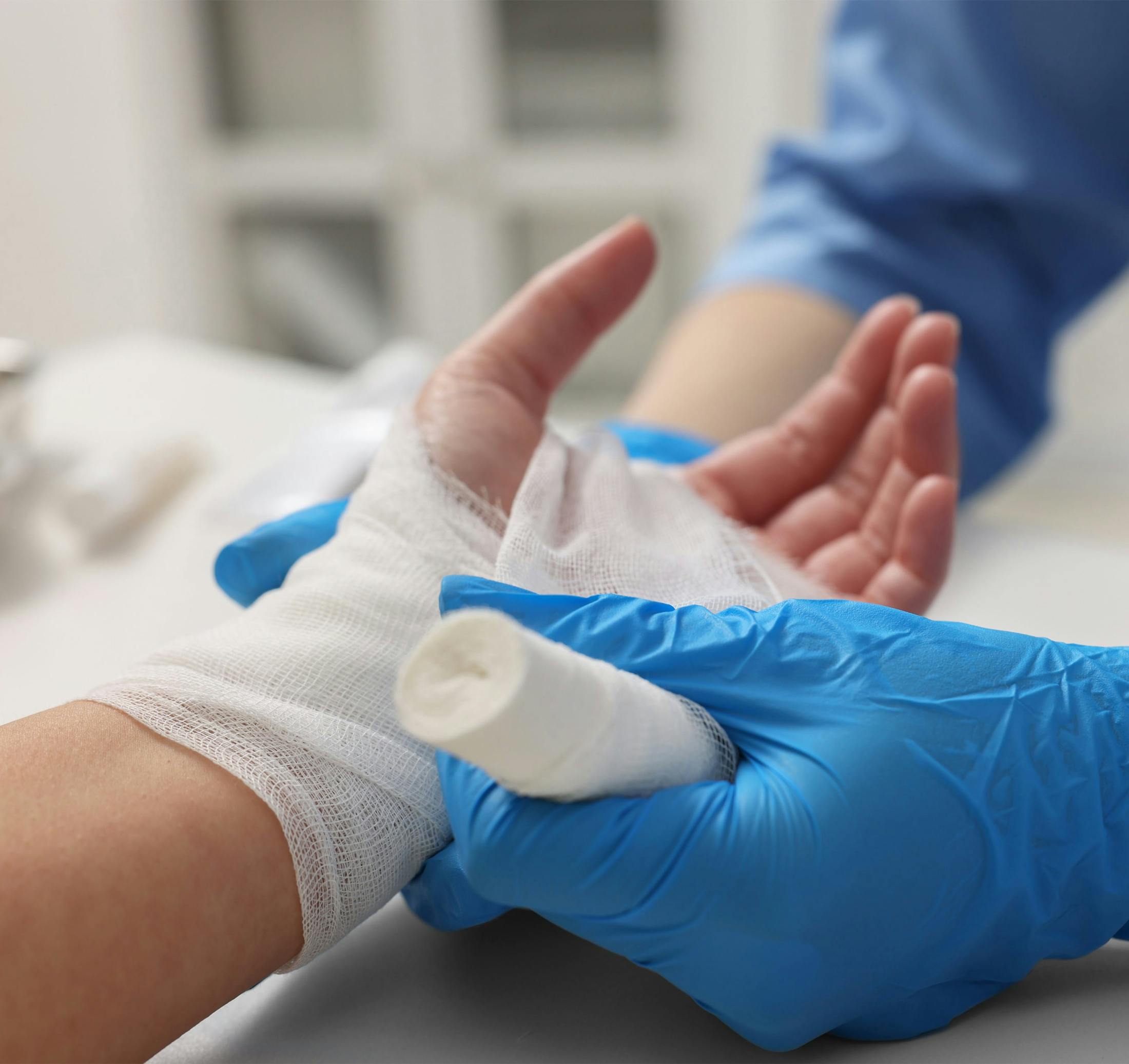 dog bitting someones arm