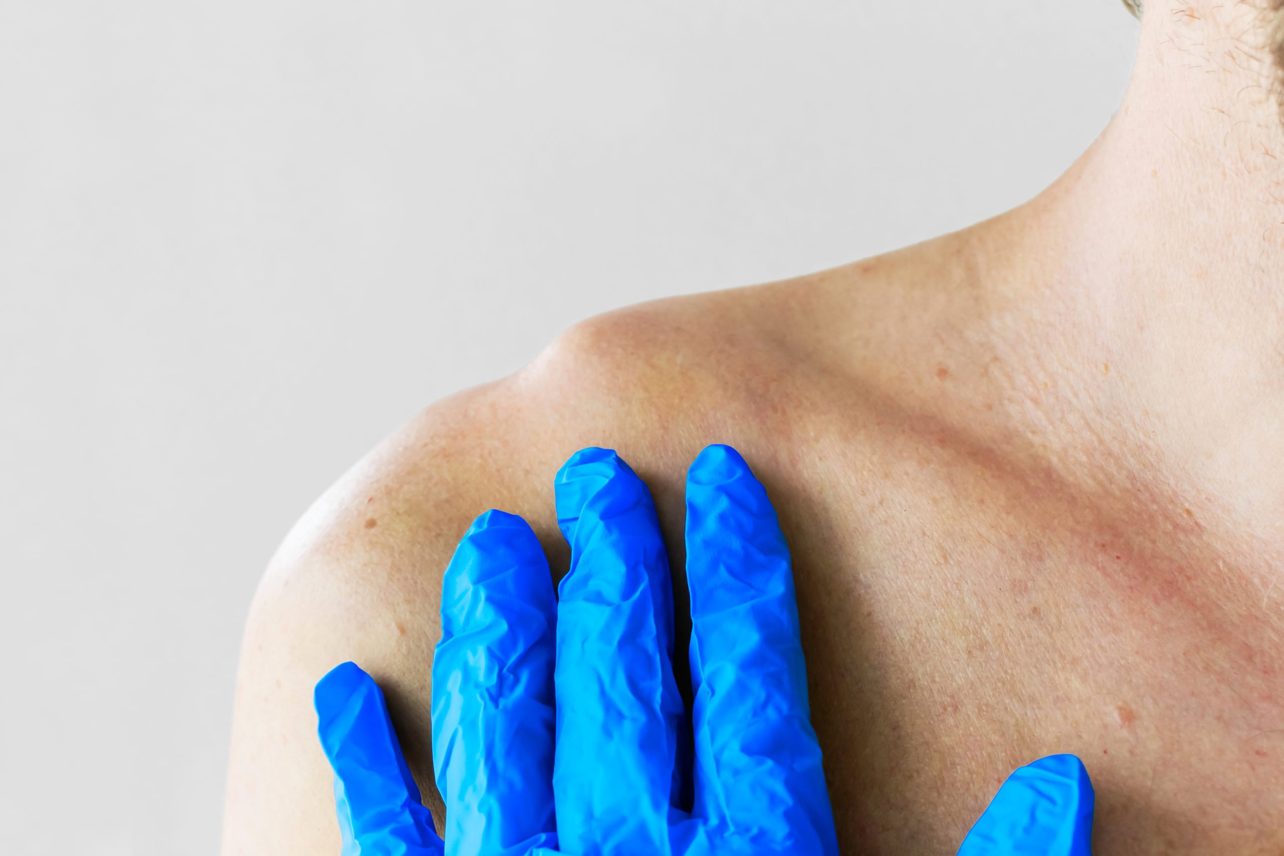 Laborde Earles Injury Lawyers FAQ | 