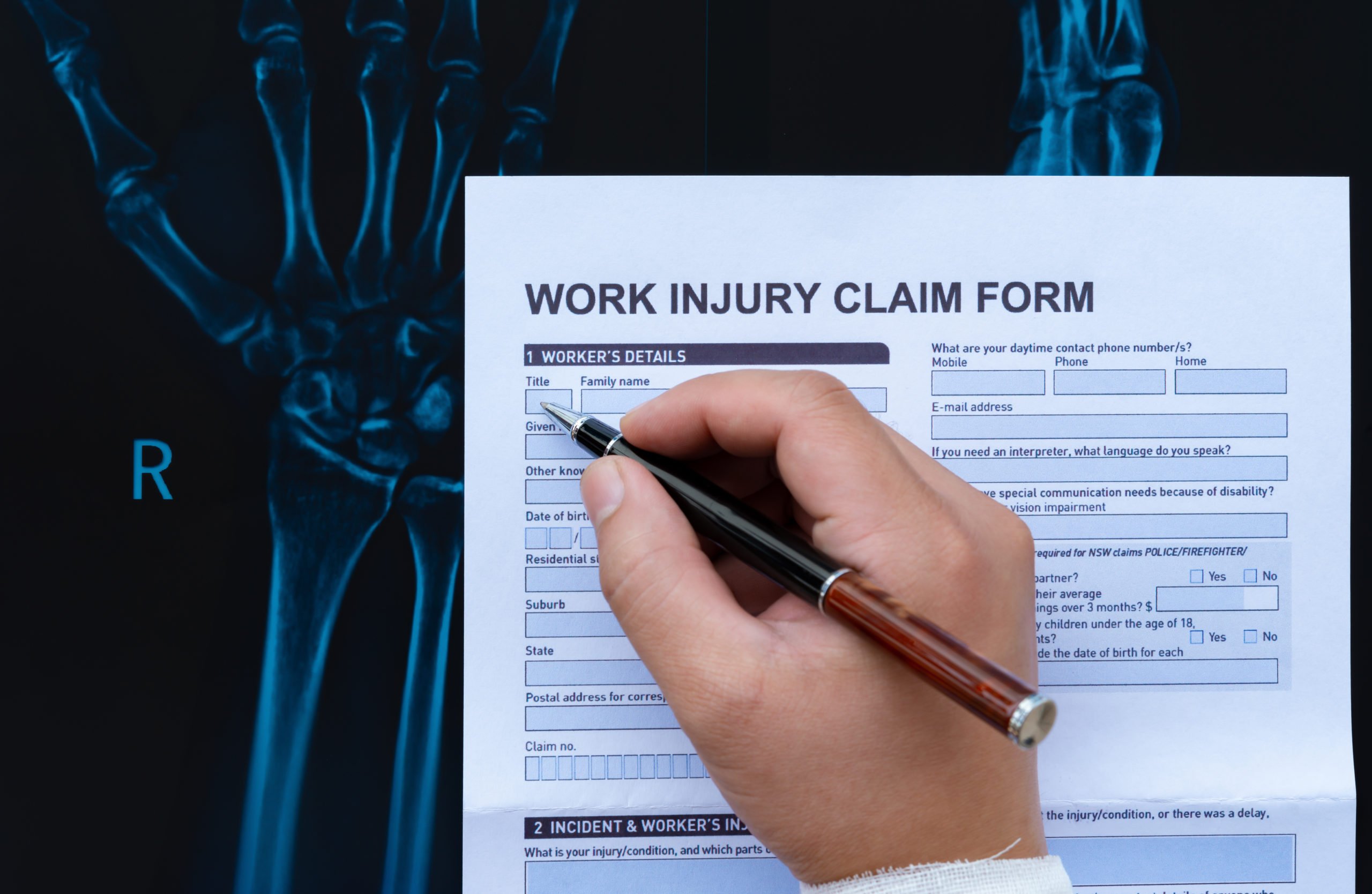 Laborde Earles Injury Lawyers FAQ | 