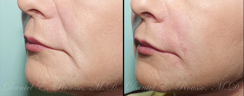 Before & After Image