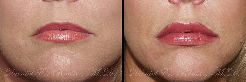 Before & After Image