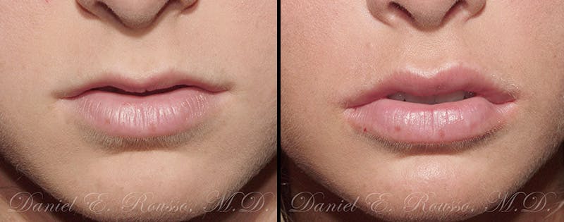 Before & After Image