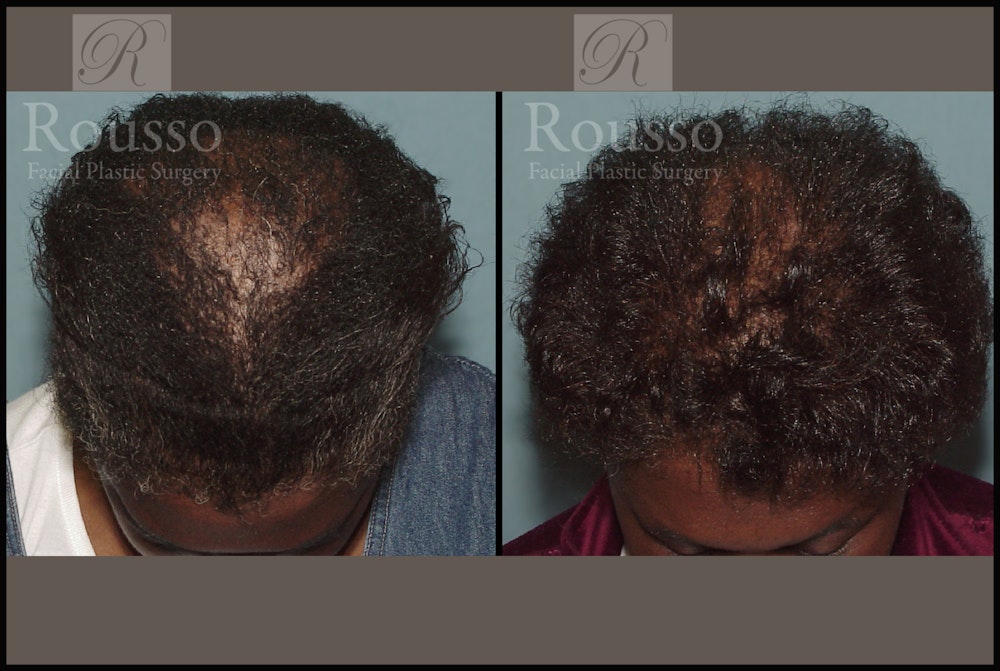 Before & After