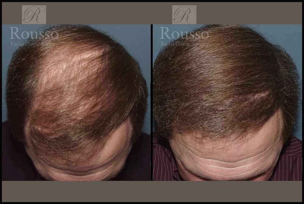 Before & After