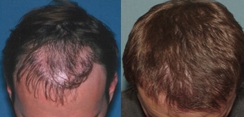 thumbs_hair_transp10-img-blog