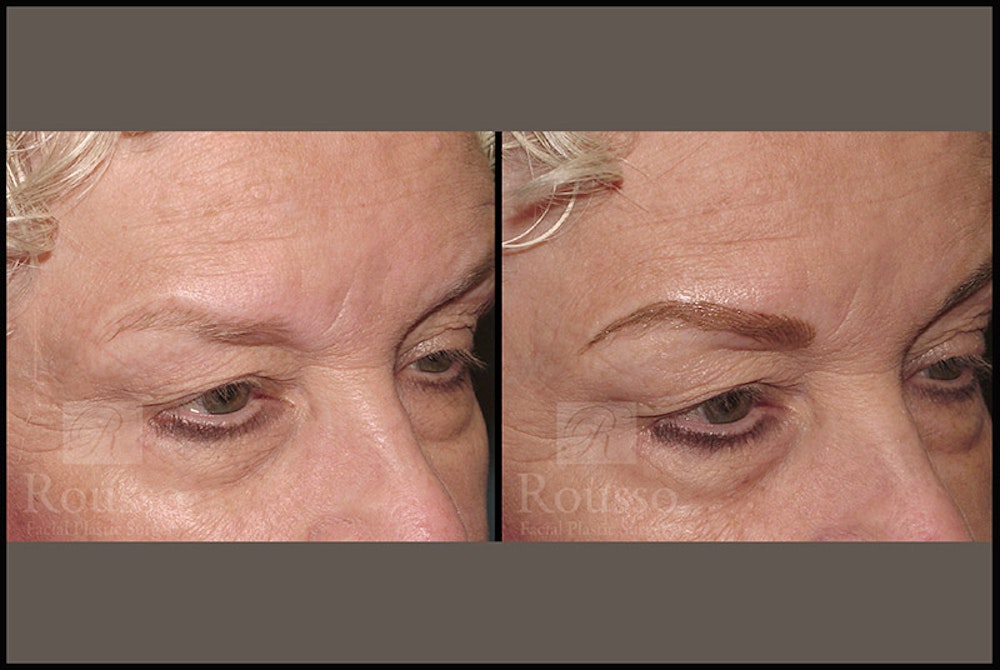 Microblading Gallery Before & After Gallery - Patient 4890747 - Image 1