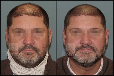 Before & After