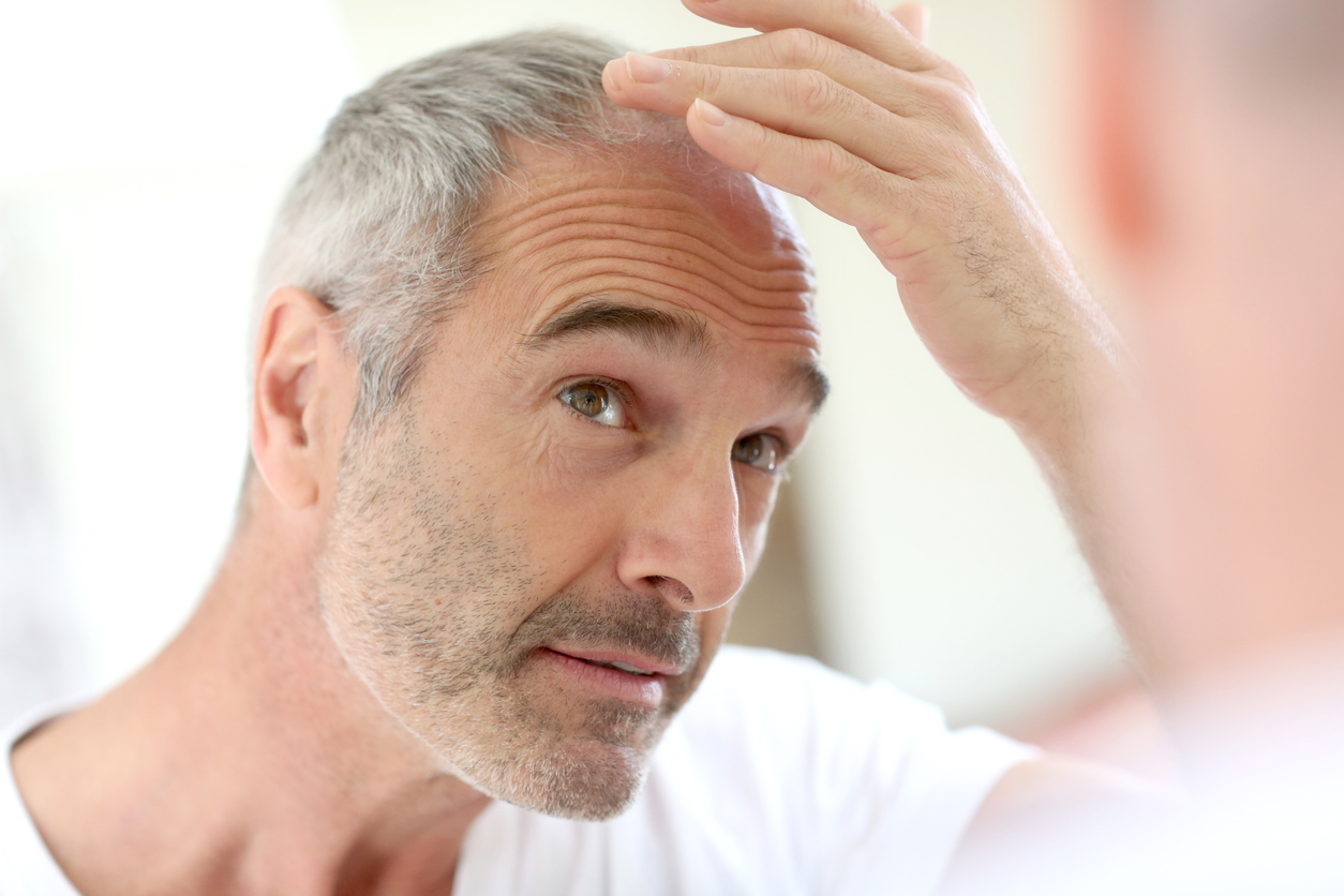 Rousso Adams Facial Plastic Surgery Blog | Why Am I Losing My Hair?