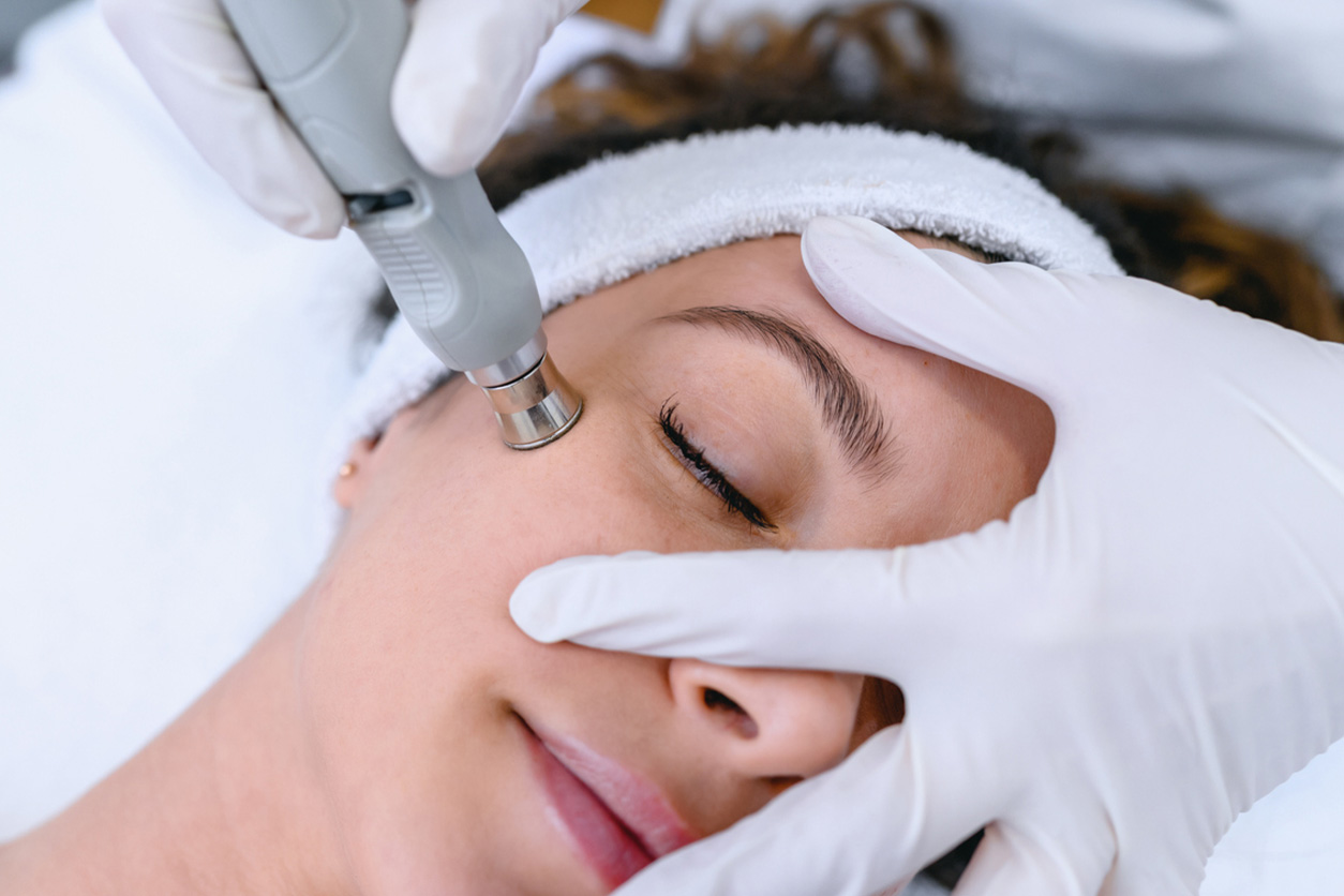 Rousso Facial Plastic Surgery Blog | How Many Laser Resurfacing Treatments Will I Need to Get?