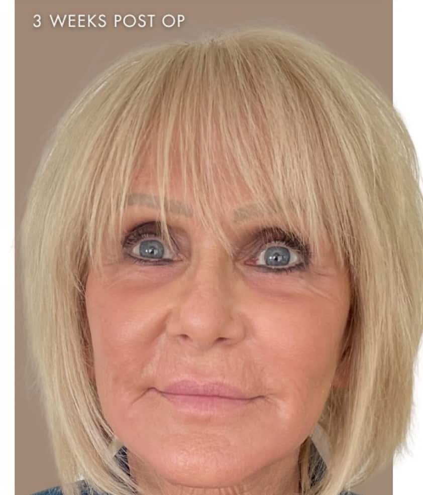 Before & After Image