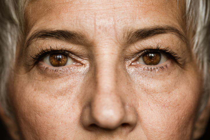 Rousso Adams Facial Plastic Surgery Blog | Upper vs. Lower Blepharoplasty: Fixing Heavy Lids vs. Under-Eye Bags Before Spring
