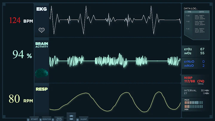 animation fast electrocardiogram reading display heartbeats are getting more intense 1