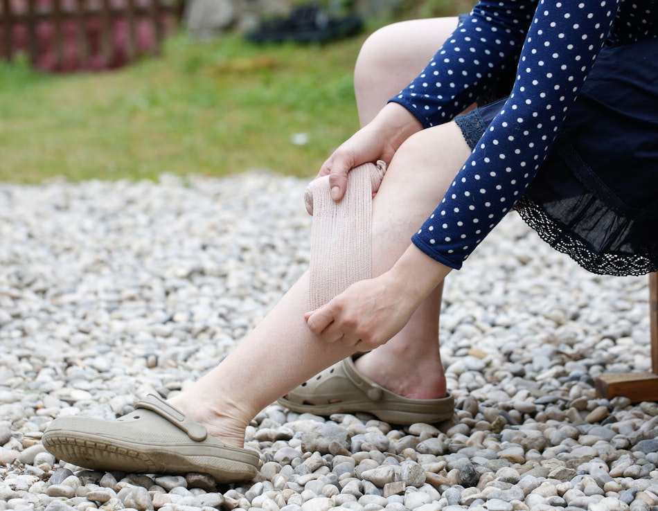 Kompressionsverband Frau bindet sich Beine mit Verband