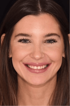 Before dental treatment