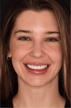 After dental treatment