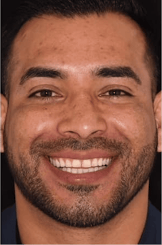 Before dental treatment