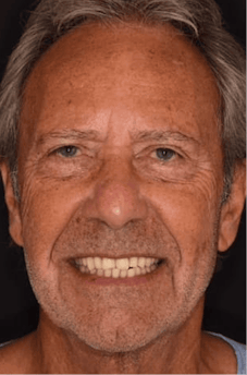 Before dental treatment