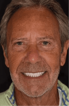 After dental treatment