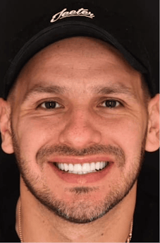 After dental treatment