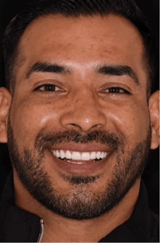 After dental treatment