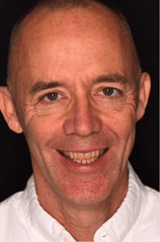 Before dental treatment