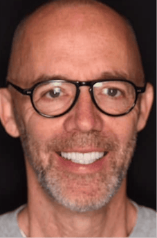 After dental treatment