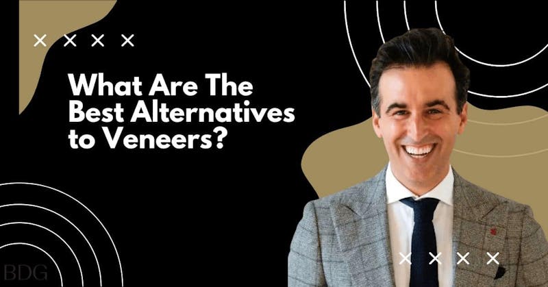 what are the best alternatives to veneers